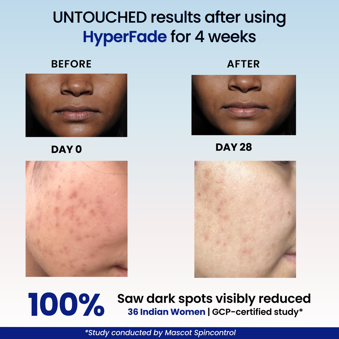 HyperFade Advanced Brightening & Repair Serum