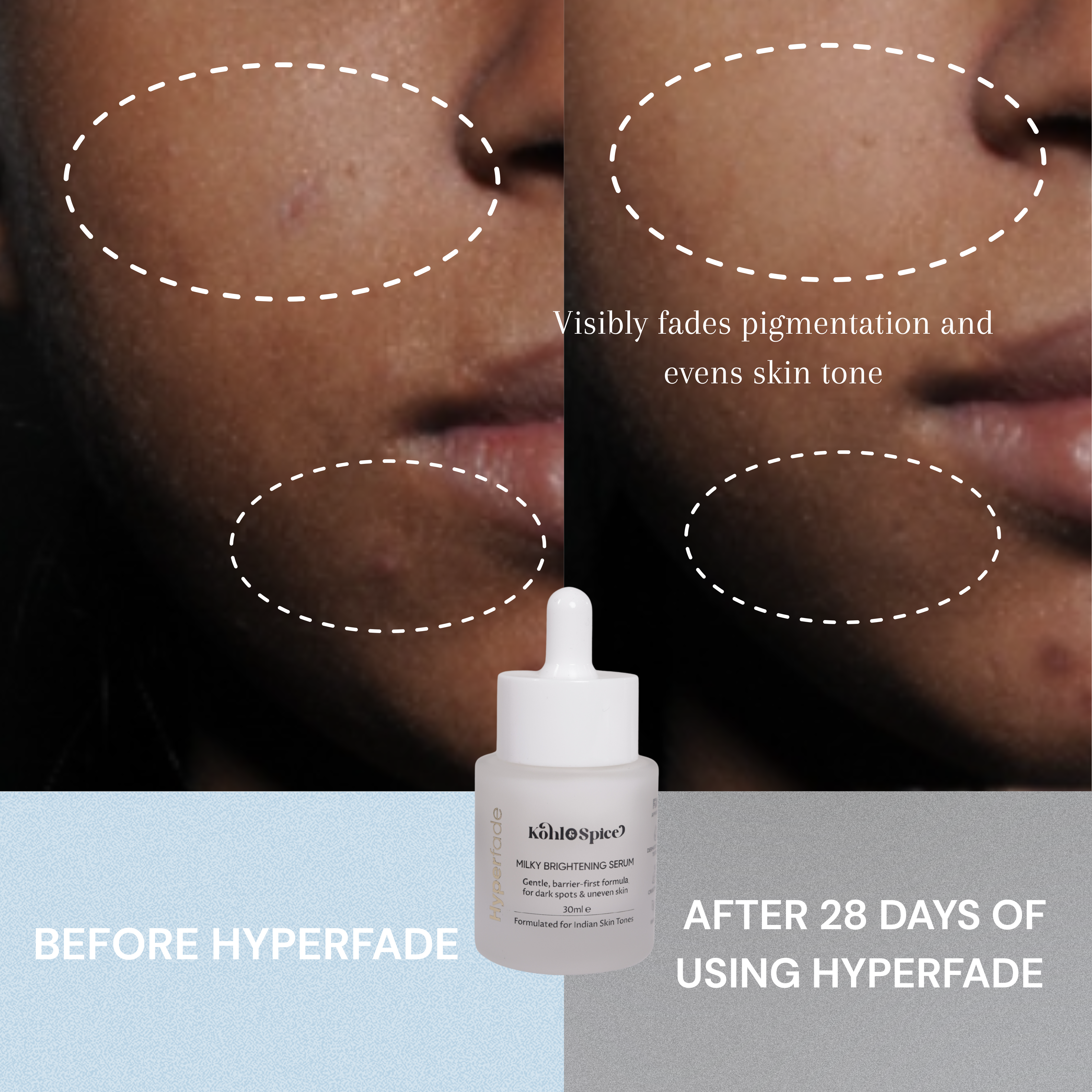 HyperFade Milky Brightening Serum